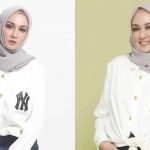 Profil Dina Lorenza, Wanita Cantik yang Diisukan Dekat dengan Ariel NOAH