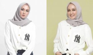 Profil Dina Lorenza, Wanita Cantik yang Diisukan Dekat dengan Ariel NOAH